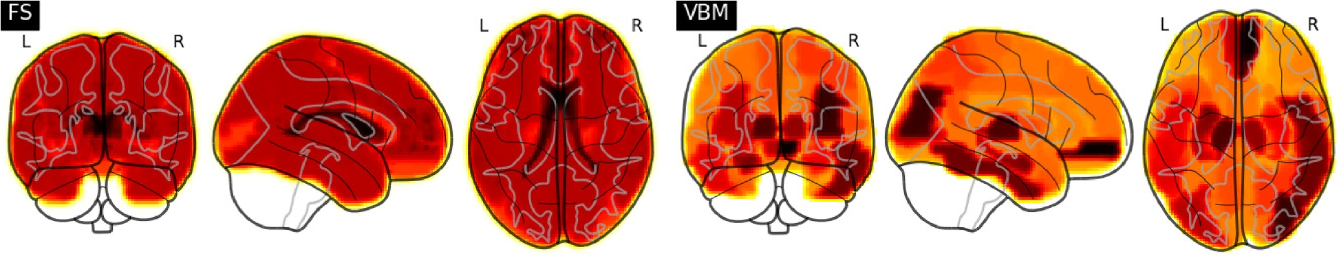 Published brain-region weight maps for FreeSurfer on the left and voxel-based morphometry on the right; darker areas carry larger model weights.